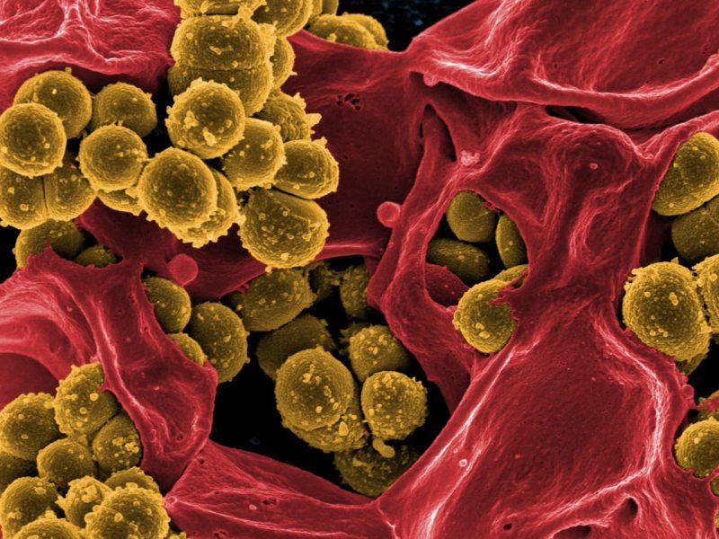 Ancaman Superbugs Meningkat, Ilmuwan Cari Solusi Baru
