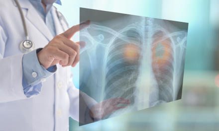 Tumor Askin, Kanker Langka pada Dinding Dada Perlu Diwaspadai