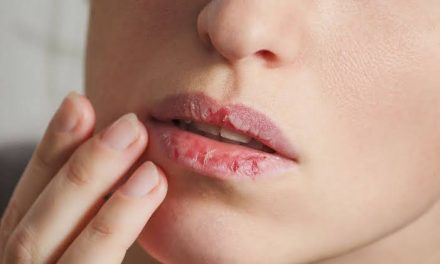 Dokter Gigi Peringatkan Bahaya Kondisi Mulut Kering