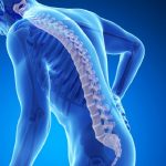 Penyakit Osteoporosis Di Tandai Penurunan Kepadatan Tulang